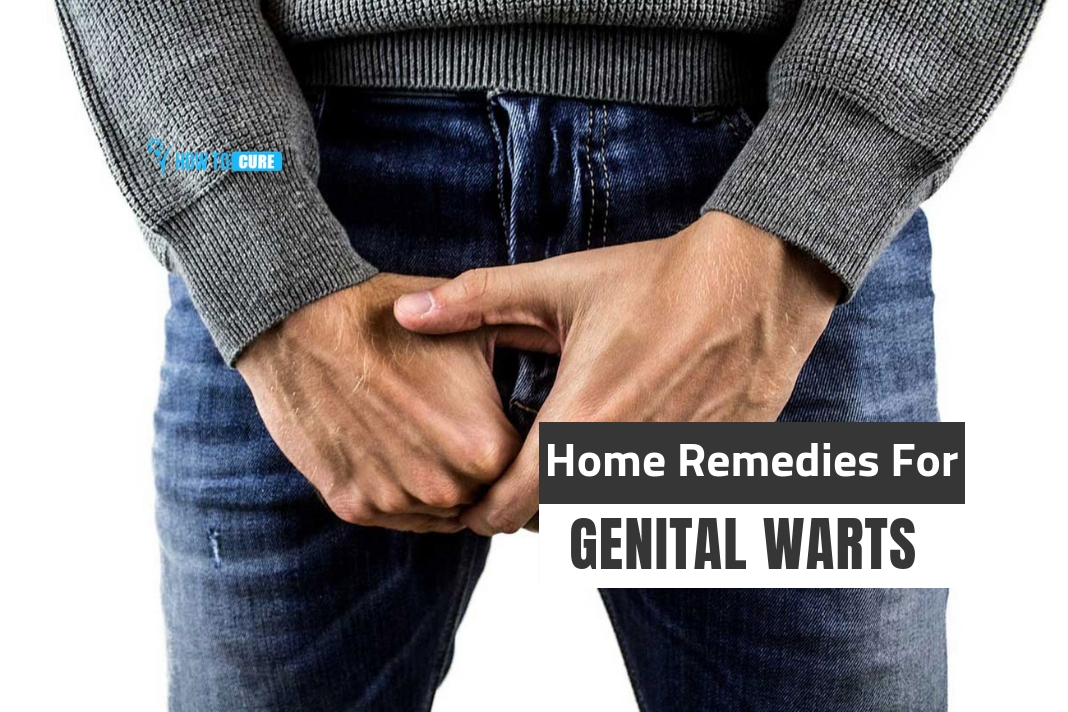 how to get rid of genital warts in mouth