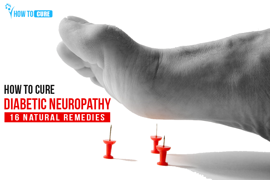How to cure diabetic neuropathy - Natural Remedie & Treatment