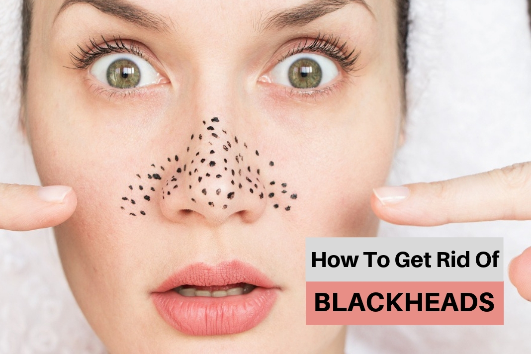 How To Get Rid Of Blackheads On Nose Easily At Home How To Cure
