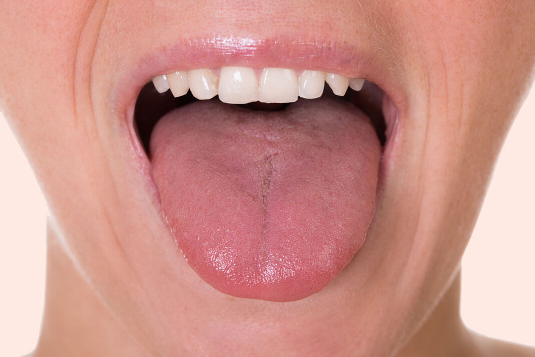 The Most Incredibly Effective Home Remedies For Dry Mouth ...